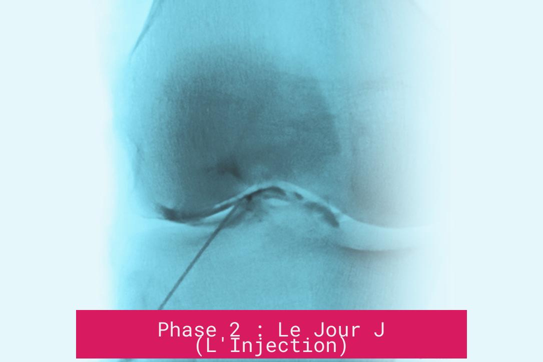 Phase 2 : Le Jour J (L'Injection)